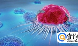 肿瘤早期5个报警信号都有哪些？