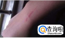 狗爪子抓红了怎么办