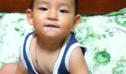 宝宝头上磕了个包怎么处理？