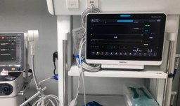 resp监护仪上什么意思？