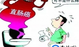 哪些人容易患肠癌