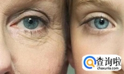 脸部有皱纹了，那怎么办呢？