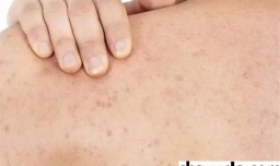 全身皮肤粗糙的原因