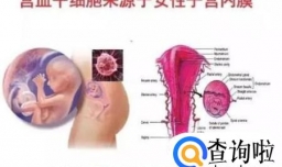 宫血干细胞可以治疗哪些疾病？