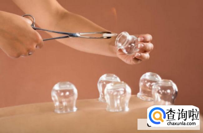 拔罐后多久能洗澡