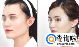 怎么样改变脸型
