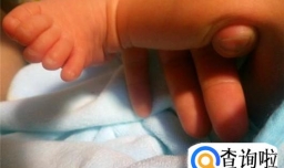 警惕宝宝足外翻
