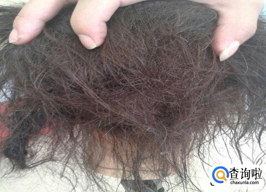 头发总是打结是什么原因造成的