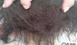 头发总是打结是什么原因造成的