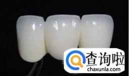 美容冠牙齿矫正步骤