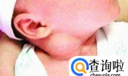 如何判断宝宝是否斜颈？