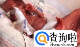 先天性皮肤缺失是什么病