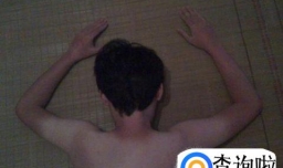 军训时晒伤应该怎样处理？