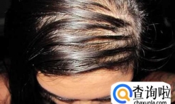 头发发油应该怎么办？