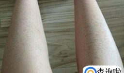 蛇皮肤怎么消除