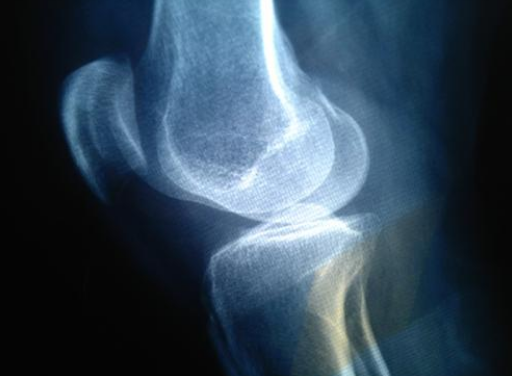 还能长高的膝盖骨特征