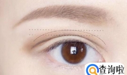 双眼皮有什么有利的方面