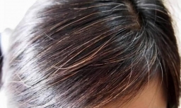 头发花白应该吃什么食物