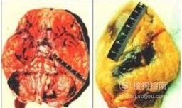 可卡因有什么危害