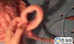 怎样快速织好毛线帽？