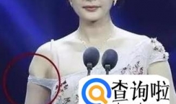 手臂粗是什么原因造成的？