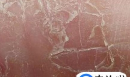 什么是干燥性湿疹