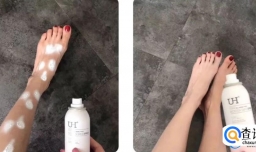 防晒喷雾过期了能喷在腿上吗