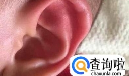 耳朵长冻疮怎么办