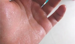 为什么有些孩子手心都是汗