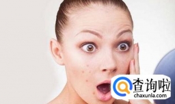 祛痘印的有效方法