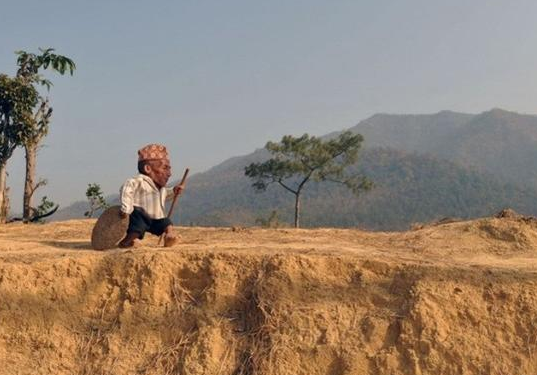 世界上最矮的人