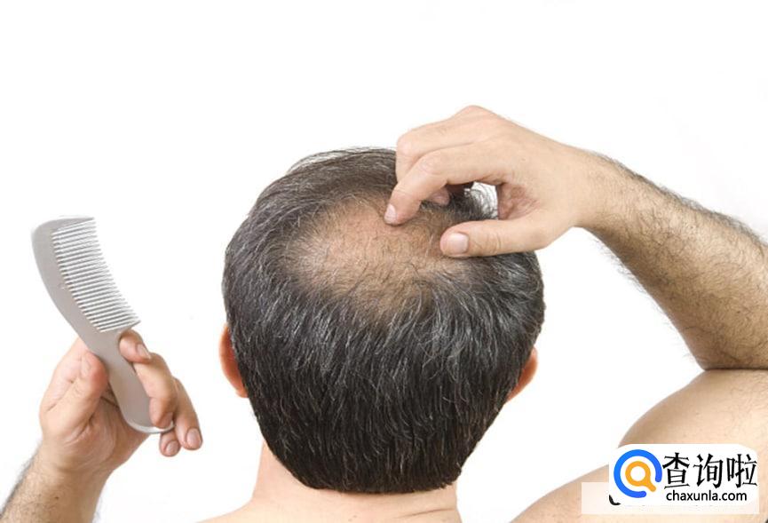 植发能不能一劳永逸