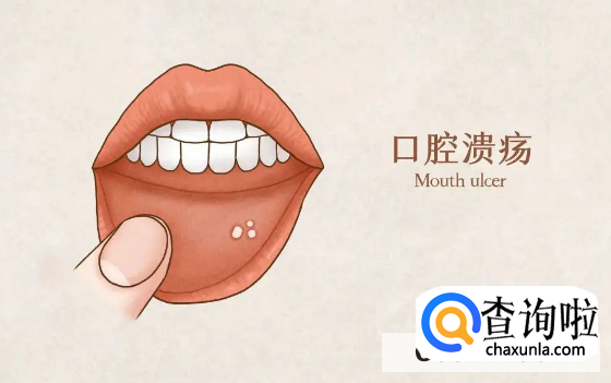 意可贴的效果怎么样？