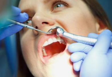 口臭的原因和治疗方法