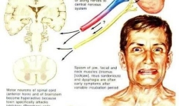 破伤风能治好吗