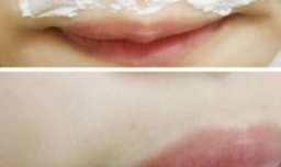 怎么才能脱唇毛