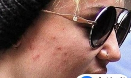 敷面膜后洗掉的好处与弊端以及正确的做法？