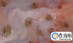 鱼虱病的诊断与治疗