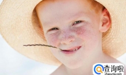 激光祛雀斑价格费用 激光祛斑单次多少钱