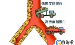 盘点常见的常染色体显性遗传疾病