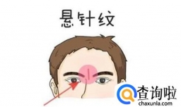 悬针纹怎么去除