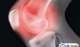 椭圆机相当于跑步吗？怎么正确使用椭圆机？