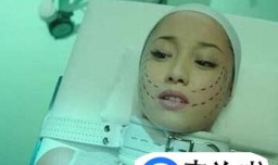 整容老了以后会怎样