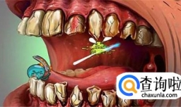 哪些情况可能使牙齿腐蚀