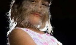 脸上长毛怎么办