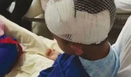 耳石症是什么原因导致的