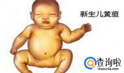 婴儿黄疸应该怎样处理