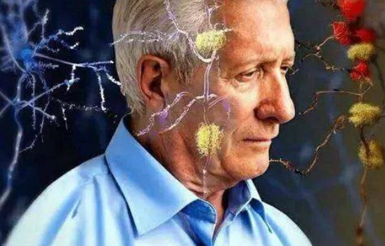 阿尔茨海默病是什么？