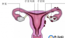 做人流会导致子宫内膜变薄吗