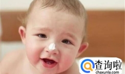 冬天宝宝脸皴怎么办